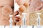 Preview: Phi Spots Microneedling Gel 5/1
